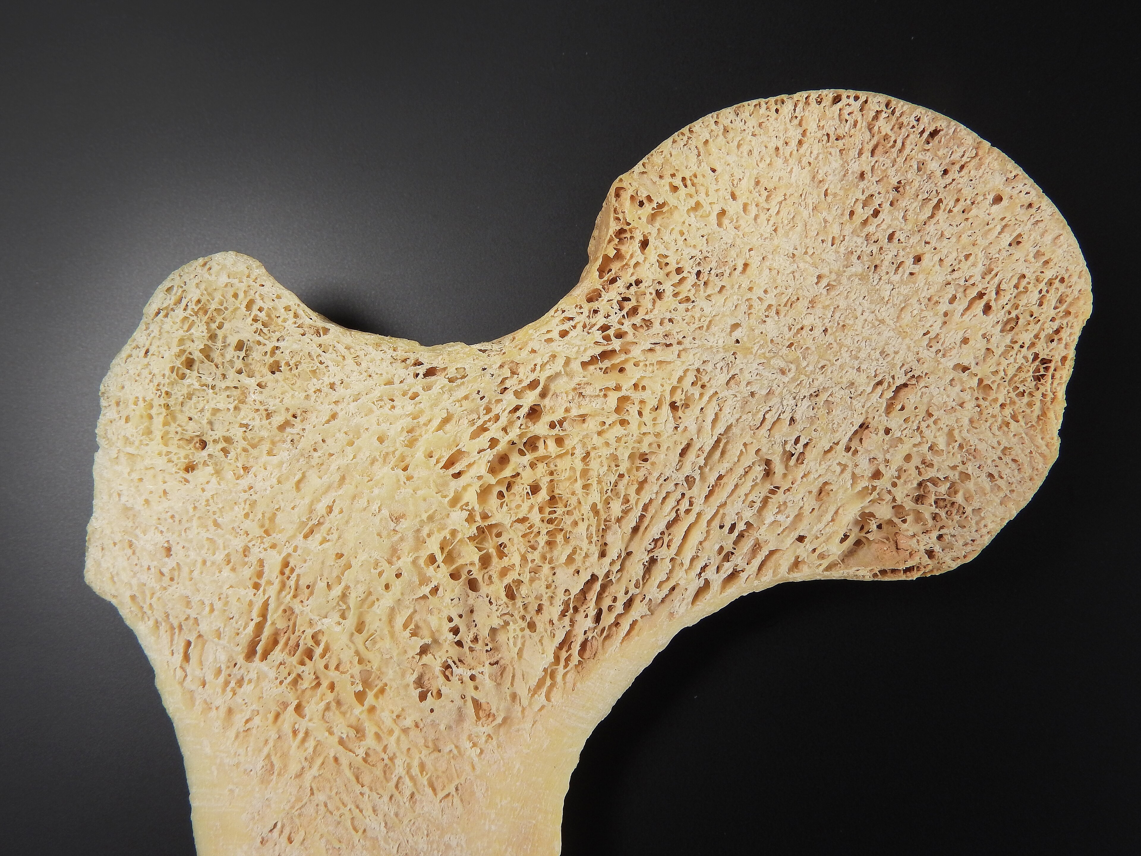 The sawn end of a bone against a black background, its cut face a dense honeycomb of fine bony struts with open spaces between them