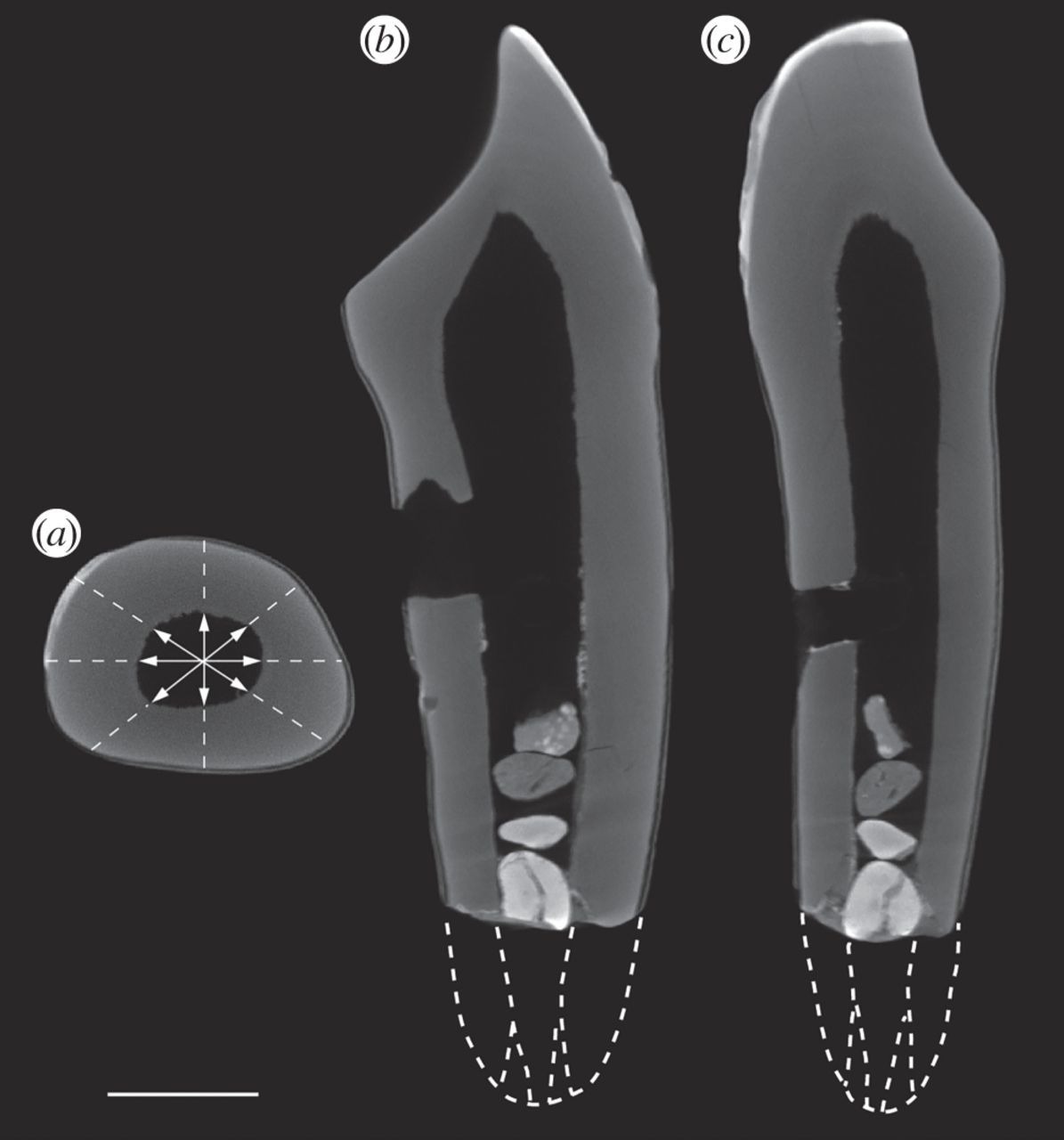 Micro-CT scan images of the Piltdown teeth from the 2016 study, showing gravel packed into the roots